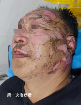 C:\Users\ADMINI~1\AppData\Local\Temp\WeChat Files\e8ed8319dd364aa8c12fcad523f541e.jpg